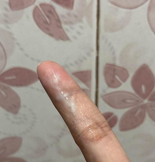 ano po ibig sabihen pag discharge ganito