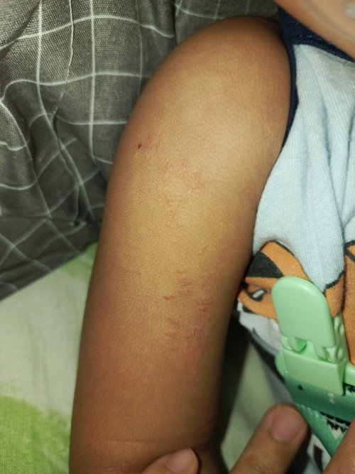 Kulit sensitif?