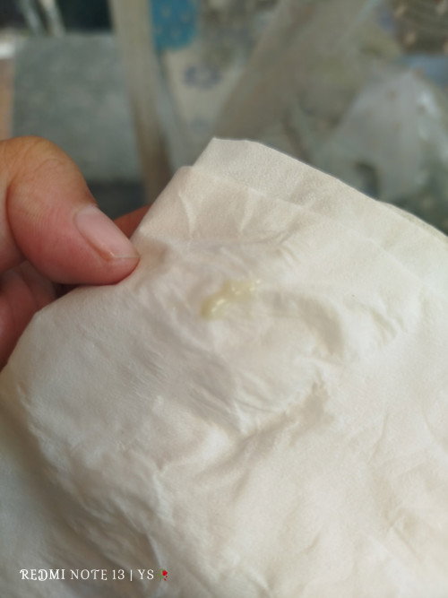 Obat keputihan, memasuki tm 3