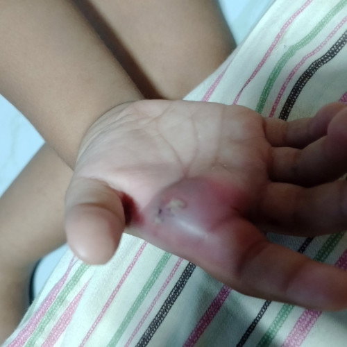 Mga mi may nakaencounter na po ba Ng ganito sa inyo? Parang d xa pigsa e..