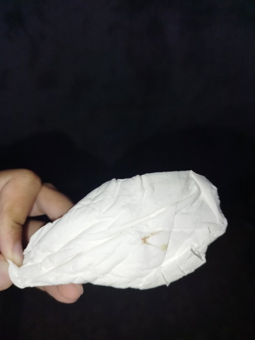 Lendir coklat setelah buang air kecil