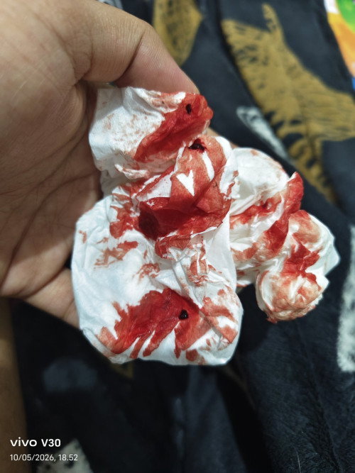 flek sdh 3 minggu hpht 06 maret
usg 7 w masih penebalan, usg 9 w masih kantung, harus nunggu 2 w lgi