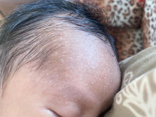 bayi 11 hari