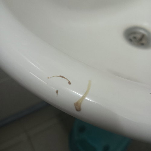 Ada keluar spotting tapi macam bertali. Coklat2. Maaf gambar kotor