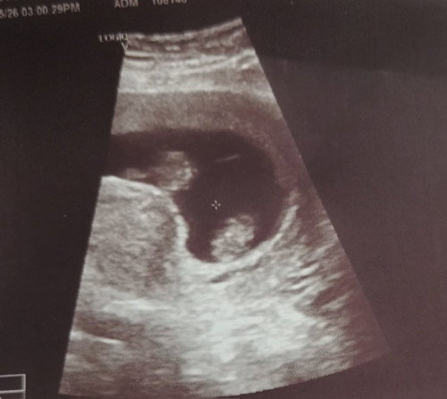 Alhamdulillah, twins 💞