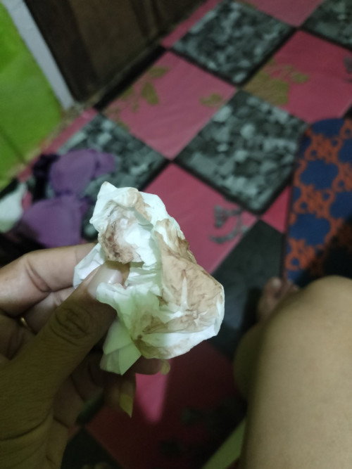 Hamil 10 Minggu keluar flek coklat 
Apa aman ?tidak disertai kram