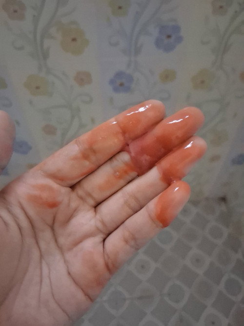 Hai bun mau tanya
Klo kluar darah seperti ini di 15 minggu usia kandungan,keluar setiap bangun tidur