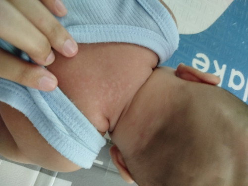 Bun ada yg tau ini kenapa ya bayi 3bln.ada bintik2 putih