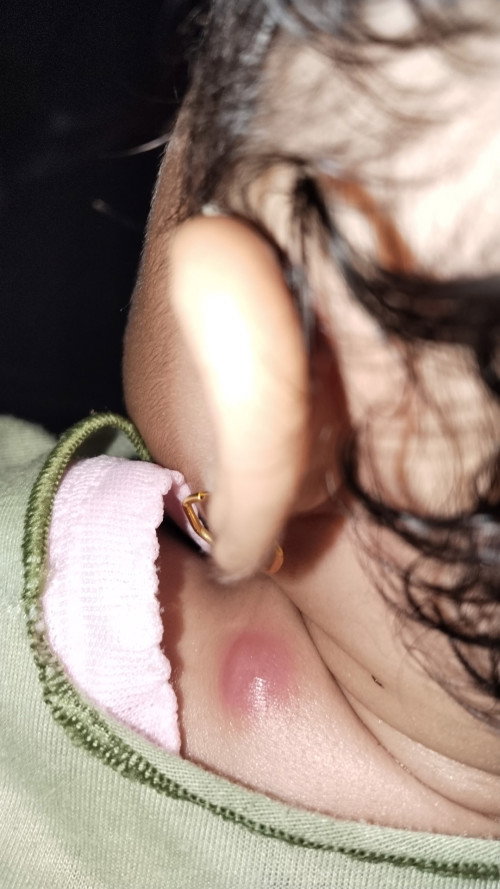 Bu ibu ini obat nya ap yah ada nd yah anknya yg prnh bgni tolong dong