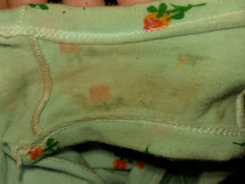 Brown discharge at 35 weeks. Anong ibig sabihin kaya nito? Nag wo-worry kase ako