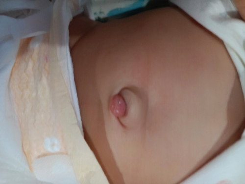 Pusar bayi#2 bln#belum kering