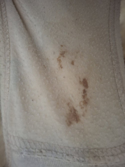 Keluar flek coklat stelah buang air kecil
