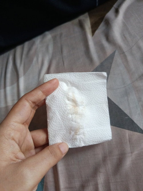 Kehamilan 11 minggu