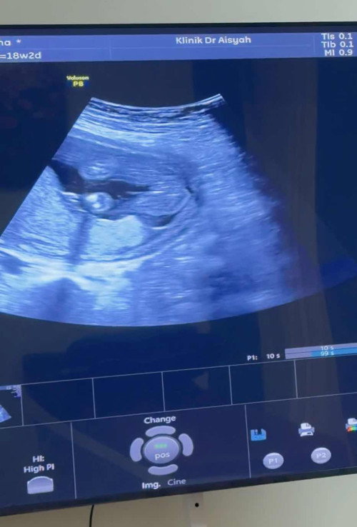 Boy or girl?