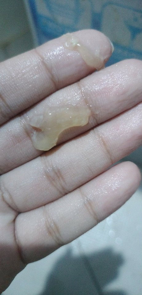 MUCUS PLUG PO BA TO?