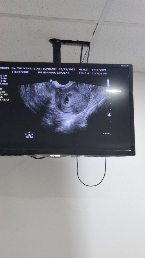 harusnya 8week usg 4week