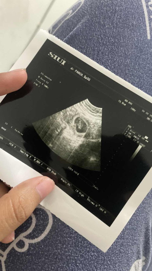 hamil 7 week
