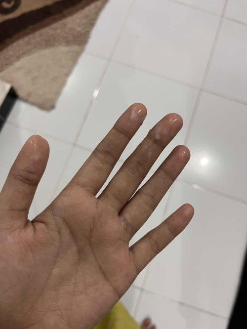 Keputihan hamil 16 minggu