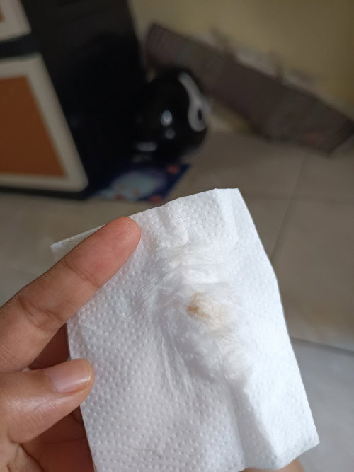 Hamil 11 minggu