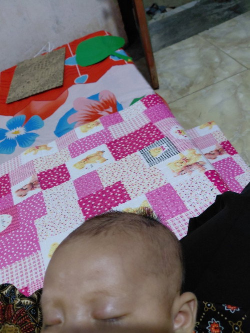 Bercak putih