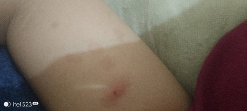 Kenapa ya kak pas hamil muncul gatal dan muncul kyk gtu