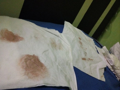 Bun aku hamil di usia 6minggu 4 hari keluar bercak merah sedikit gpp kan