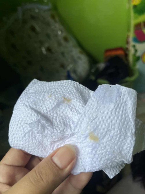 38+4 มีมูกใสๆ คล้ายเจล