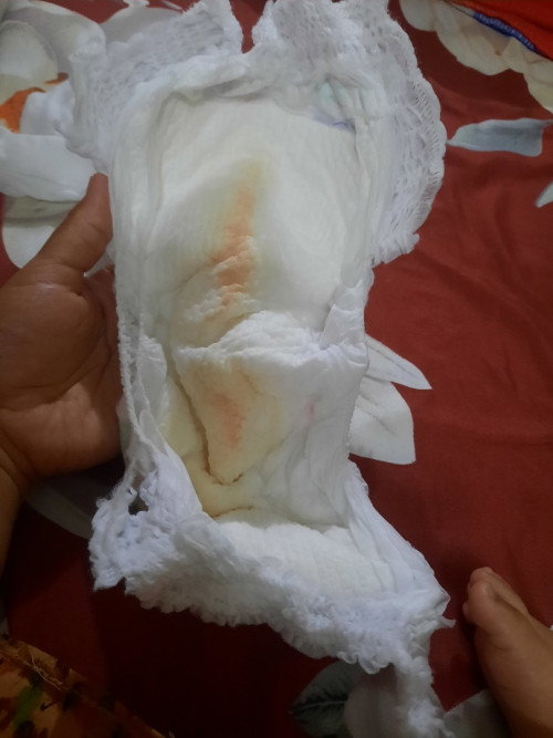 Pipis bayi