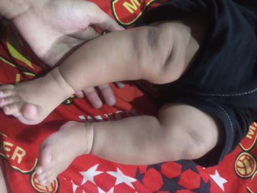 Kaki bayi 5 bulan