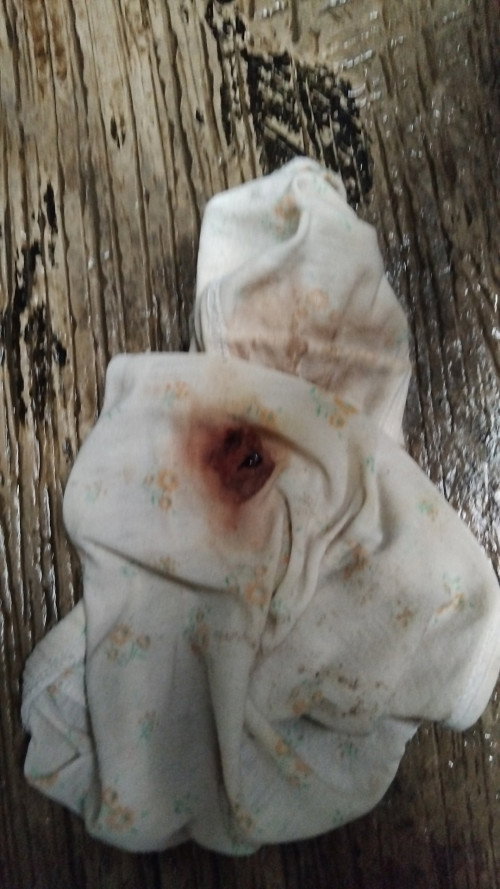 Bun mau tanya adakah yang sama kaya saya hamil 20w kluar lendir darah , saya takut