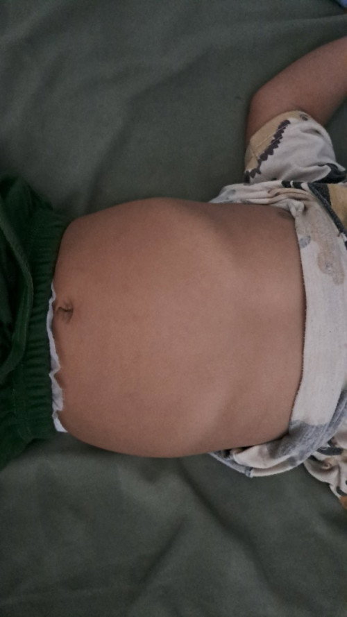 Tulang rusuk bayi 10 bulan