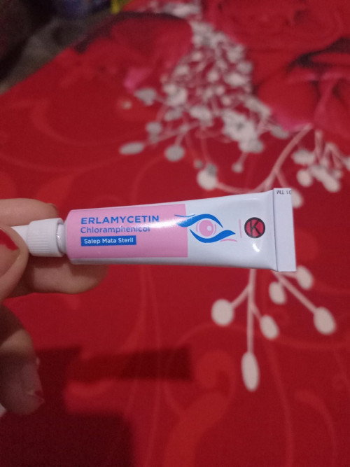 Bayi umur 2 minggu masih belekan