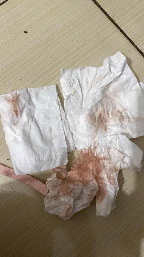 hpl 21 mei keluar flek darah