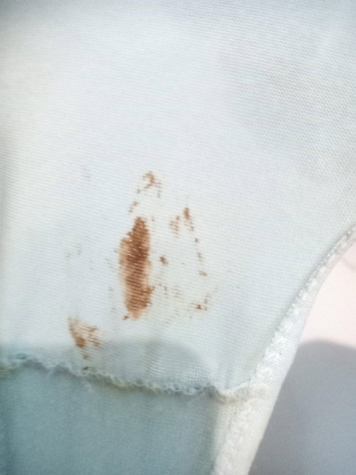 Maaf mama mau tanya, kehamilan 38w keluar flek coklat tapi masih kenceng aja blm yg mules kontraksi