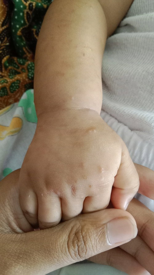 Masalah kulit bayi
