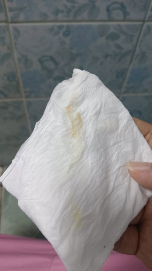 แบบนี้ต้องรออีกกี่วันถึงเจ็บท้องคลอดคะ