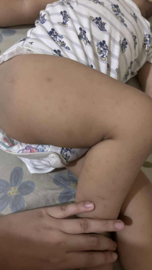 Bintik2 anak 1 tahun