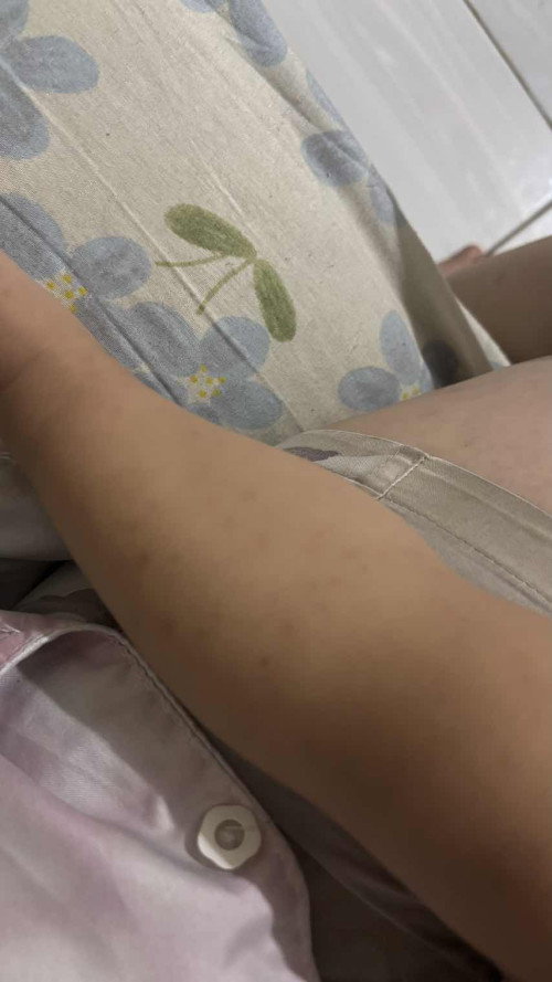 Bintik2 anak 1 tahun