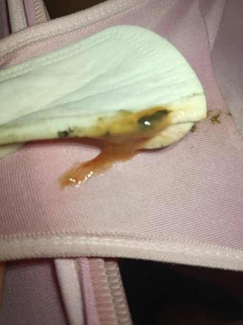Mocus plus o gawa lang ng almoranas to? Wag e open ang pic pag masilan.