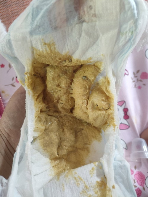 อึลูกสีแบบนี้ปกติไหม
