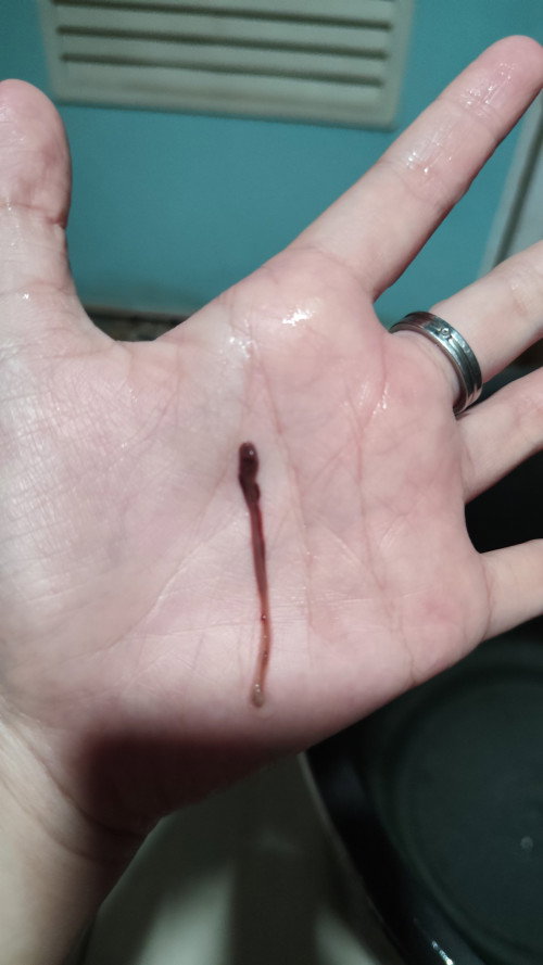 Flek Coklat Tua/Muda