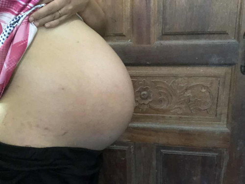 37week+5 เเบบนี้คือท้องลงข้างล่างพร้อมจะคลอดรึยังคะเเม่ๆ ท้องขนาดนี้ถือว่าเล็กไปรึป่าวคะ🥰