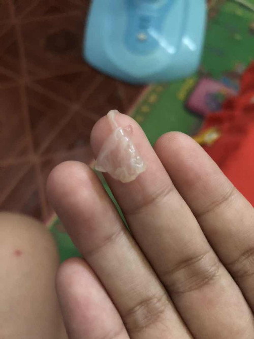 ท้องได้33วิกเเล้วอันนี้ตกขาวรึมูกใสคะ ท้องเเรกอาจไม่รู้เท่าไรนะเเม่ๆ ต้องไปหาหมอไหมคะ