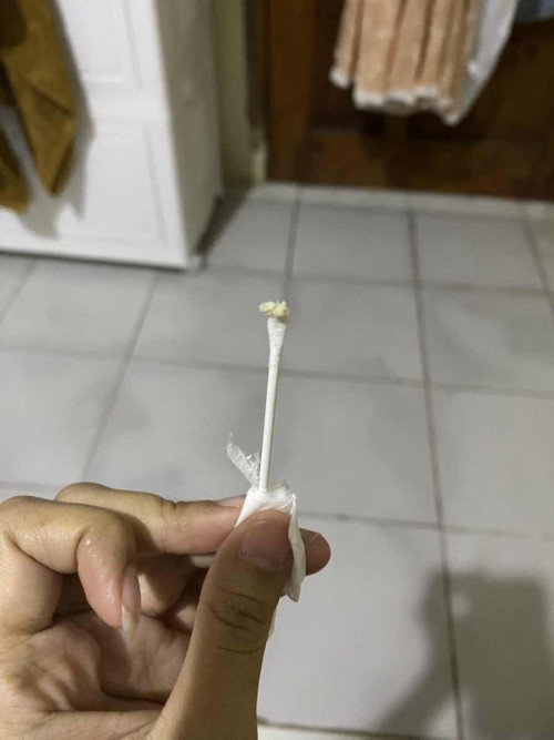 Keputihan gatal