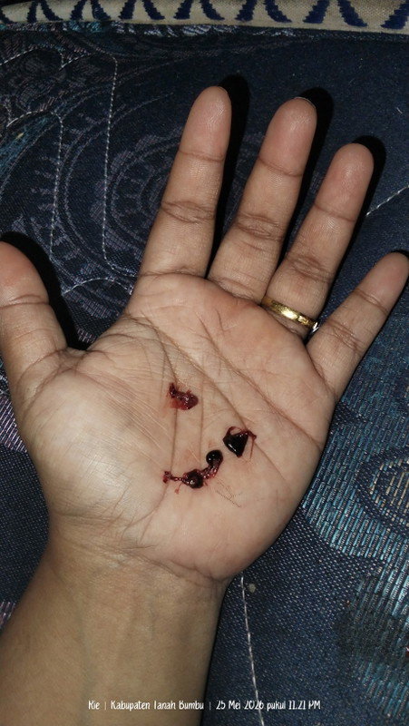 Keluar darah