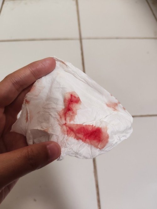 Hamil ke dua di trimester 1