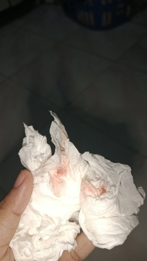 masuk 8 week, malah ada muncul b rcak darah gini. tapi gk sakit