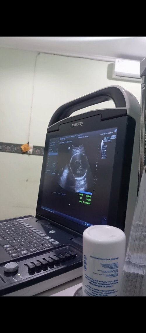 32-33 week