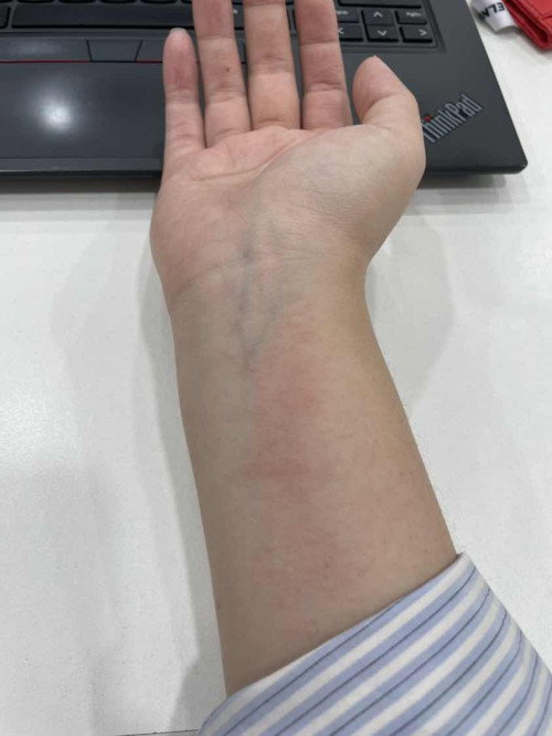 Kulit perut, pinggul, paha, tangan ruam gatal