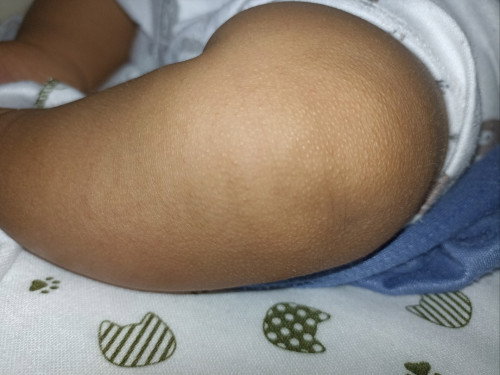 Permasalahan kulit bayi